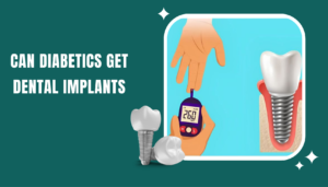 Dental implant replacing a missing tooth in a diabetic patient
