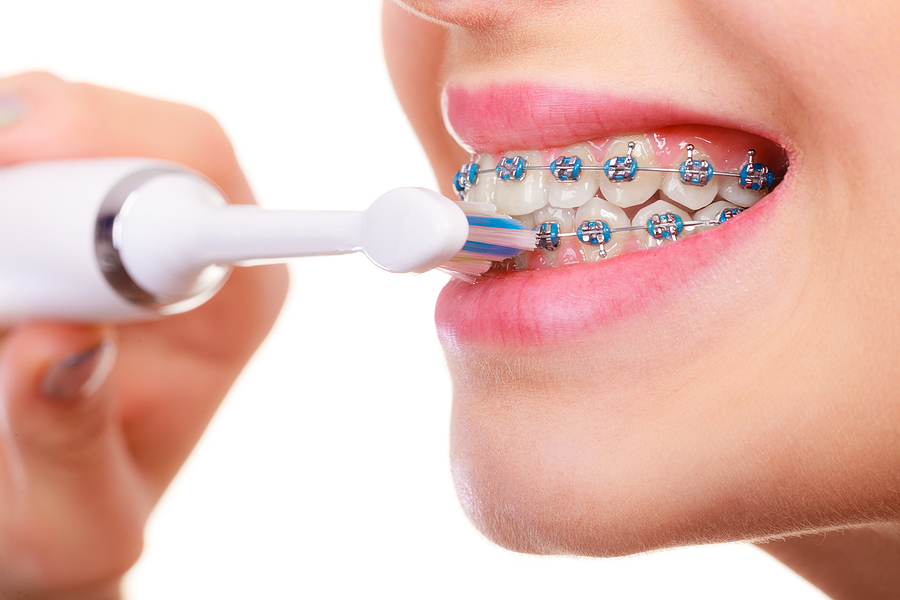 Orthodontic patient using an electric toothbrush with braces