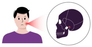 Patient experiencing TMJ pain near the jaw joint