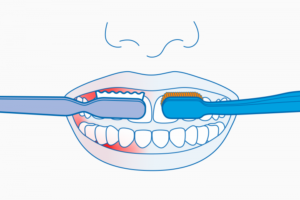 Person experiencing bleeding gums while brushing teeth