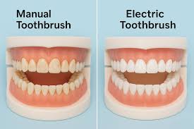Electric and manual toothbrush removing plaque from teeth
