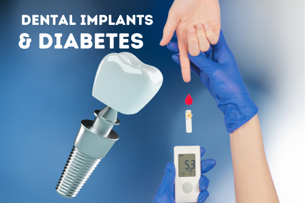 Dental examination before implant treatment for diabetes patients